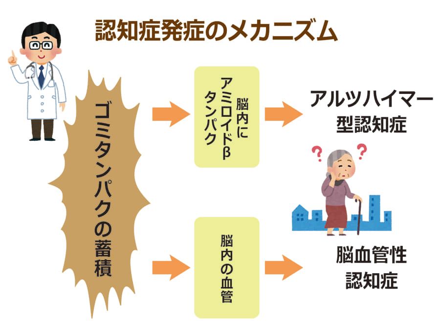 認知症の予防に効果がある食材総まとめ 食生活の改善で ゴミタンパク を溜めない介護予防を ニッポンの介護学 みんなの介護