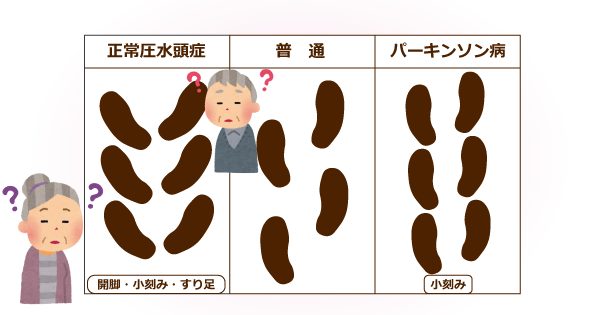 認知症はどんな病気？・生活する上で記憶力が身につかない・物事の流れなどの判断力が低下する、認知症とは“覚えられられない病気”