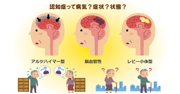 「自分のことは自分で」認知症でも日常生活は自分で。身体能力が衰えない介護をしてあげましょう！