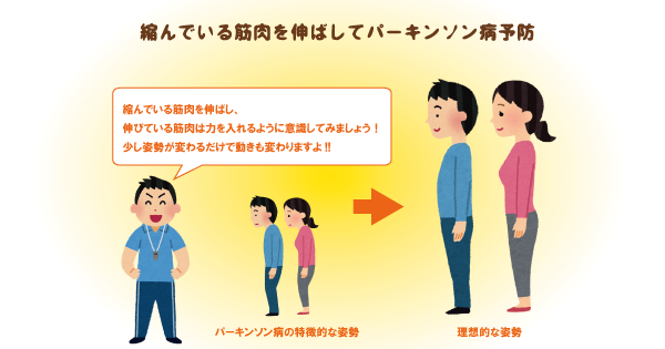 パーキンソン病の症状とは？症状と予防法を解説！早期発見＆リハビリで進行を遅くすることも可能！