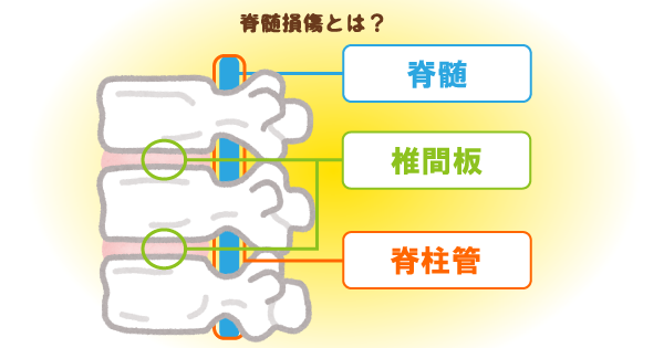 脊髄損傷の麻痺の程度で日常生活動作が大きく異なる！リハビリのポイントを理学療法士が解説