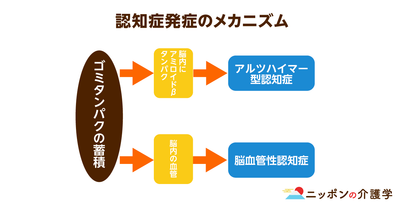 大豆がアルツハイマー型認知症予防に効果的？「アミロイドβ」を溜めない食生活を心がけよう