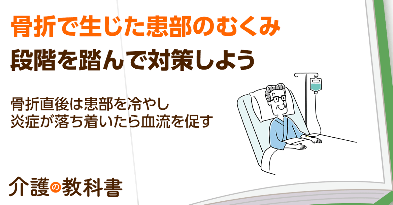 【骨折後の足のむくみはいつまで？】むくみの原因と取り方を解説！リハビリへの影響と5つの対策方法