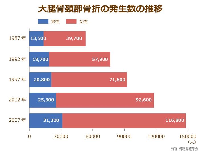 骨粗しょう症学会が発表している1987年から2007年にかけての大腿骨頚部骨折の発生数の推移を示したグラフ