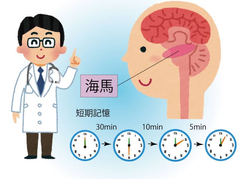 海馬のダメージで短期記憶時間が減少