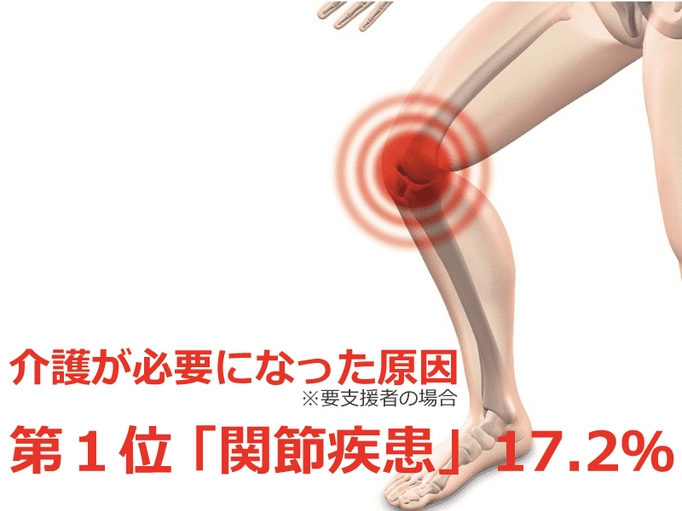 日本は膝痛大国 膝が伸びない 痛い 曲がらない 理学療法士が教える 注射 薬に頼らない簡単セルフケア 介護の教科書 みんなの介護