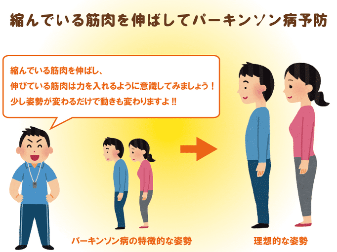 パーキンソン病を知る どんな病気もまずは知ることが大事 理学療法士が教えるパーキンソン病の症状と特徴 介護の教科書 みんなの介護