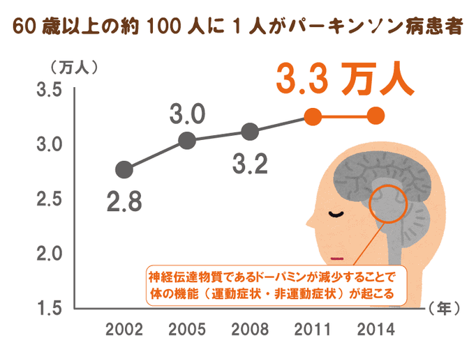 パーキンソン病を知る どんな病気もまずは知ることが大事 理学療法士が教えるパーキンソン病の症状と特徴 介護の教科書 みんなの介護