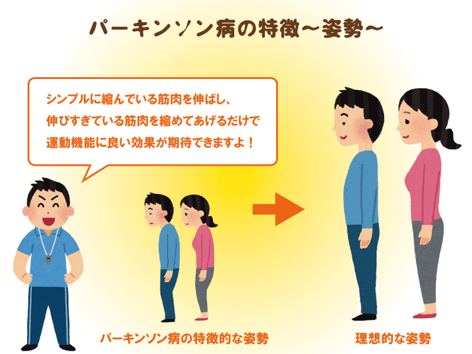 パーキンソン病を知る 薬物療法と運動療法を組み合わせ 身体機能の維持 回復をはかる 自宅でできる運動療法３つ 介護の教科書 みんなの介護