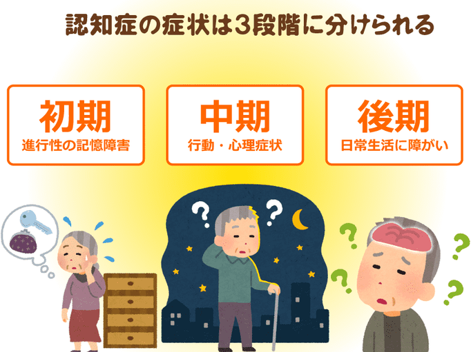 認知症症状の経過 初期 中期 後期症状を知り 症状の 背景 を考えてあげましょう アルツハイマ型認知症編 介護の教科書 みんなの介護