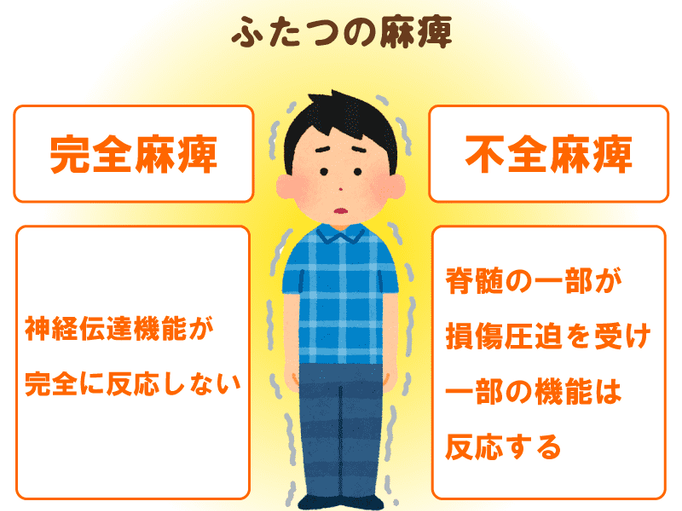 脊髄損傷で身体麻痺 自宅でもできるリハビリで 残された機能を最大限に活かす 脊髄損傷のリハビリ編 介護の教科書 みんなの介護 脊髄損傷で身体麻痺 自宅でもできるリハビリで 残された機能を最大限に活かす 脊髄損傷のリハビリ編 介護の教科書 みんなの介護