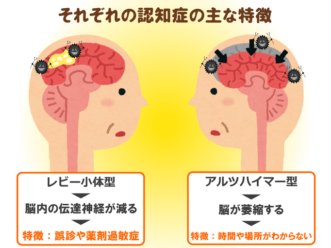 現役看護師が教えるレビー小体型認知症の方への対応方法 幻視には肯定も否定もしない 起こすときは揺すらずカーテンを開ける 介護の教科書 みんなの介護