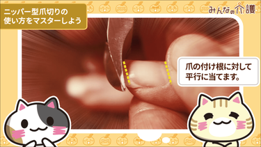 動画 ニッパー型爪切りの使い方 みんなの介護 動画 ニッパー型爪切りの使い方 みんなの介護