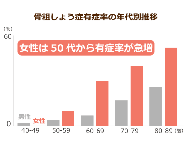 骨粗しょう症有症率の年代別推移