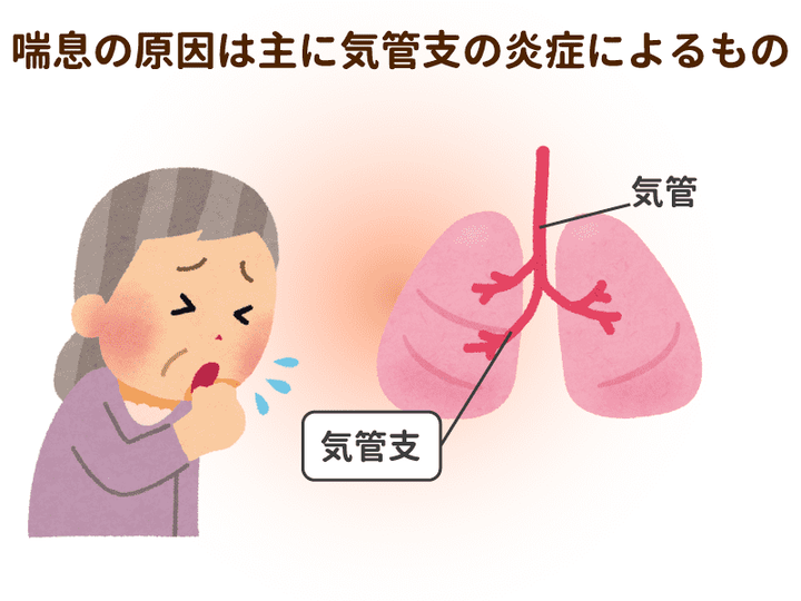 喘息ポンプの正しい使い方を学ぶ