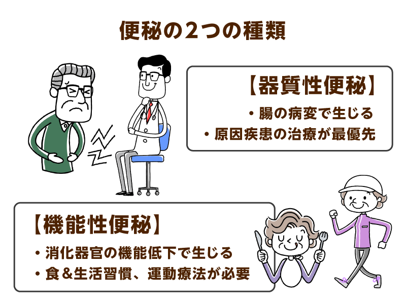 便秘の種類の説明イラスト