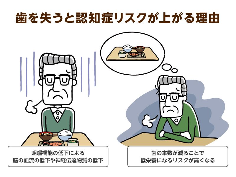 口腔ケアを日頃からしっかりと行おう