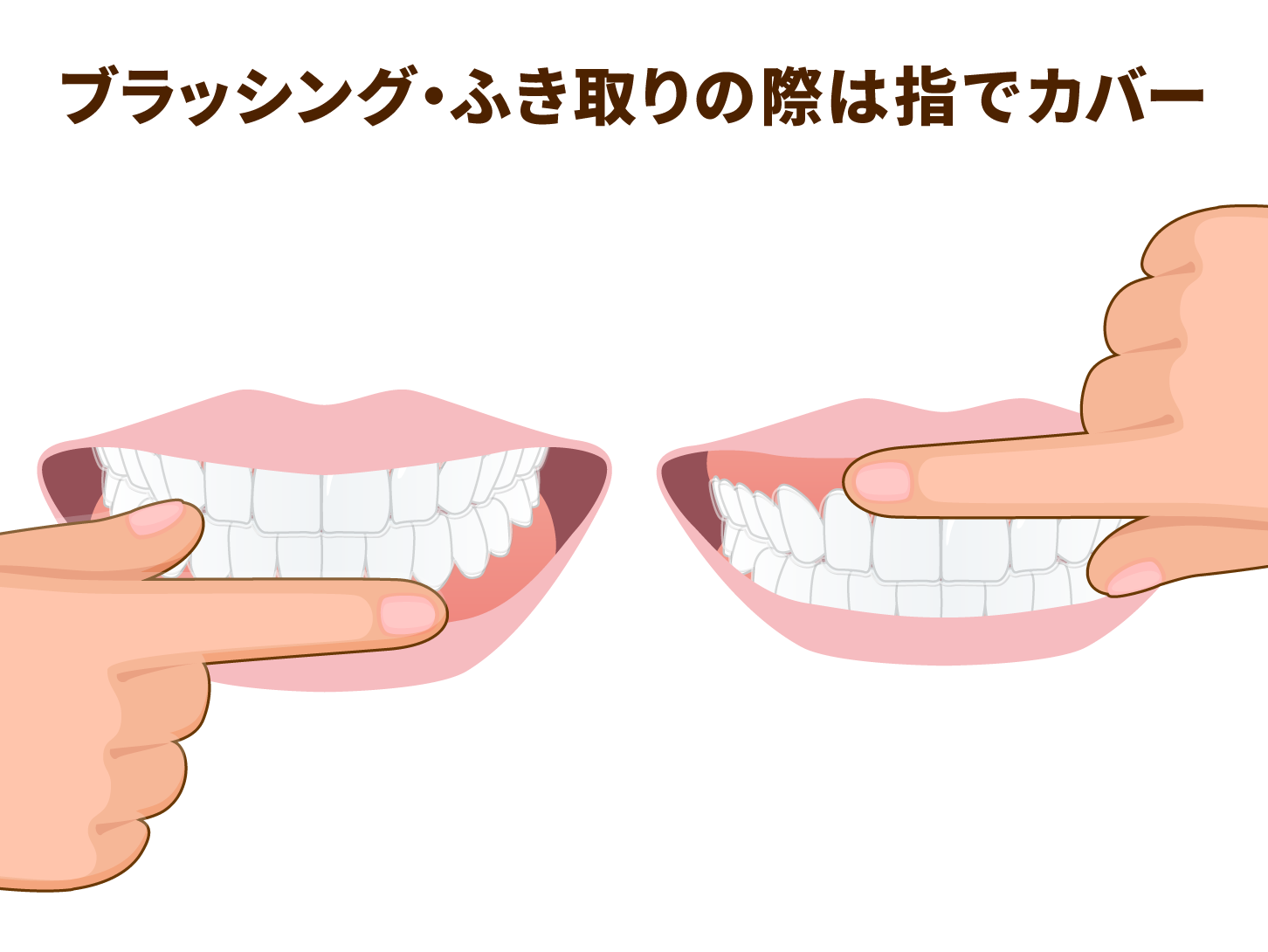 深緑(ふかみどり) 介護セット 嚥下 嚥下困難 食事介助 口腔ケア 開口