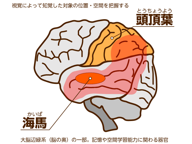 アルツハイマー型認知症になる脳の図解