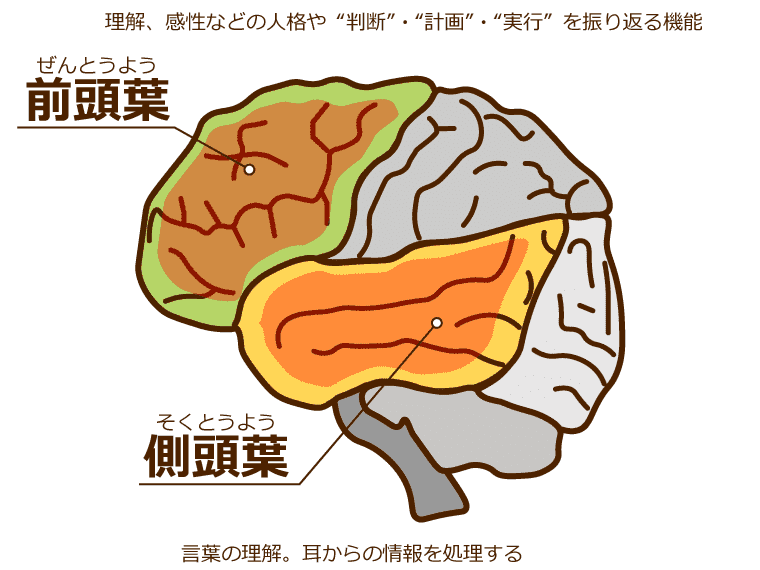 前頭側頭型認知症になる脳の図解