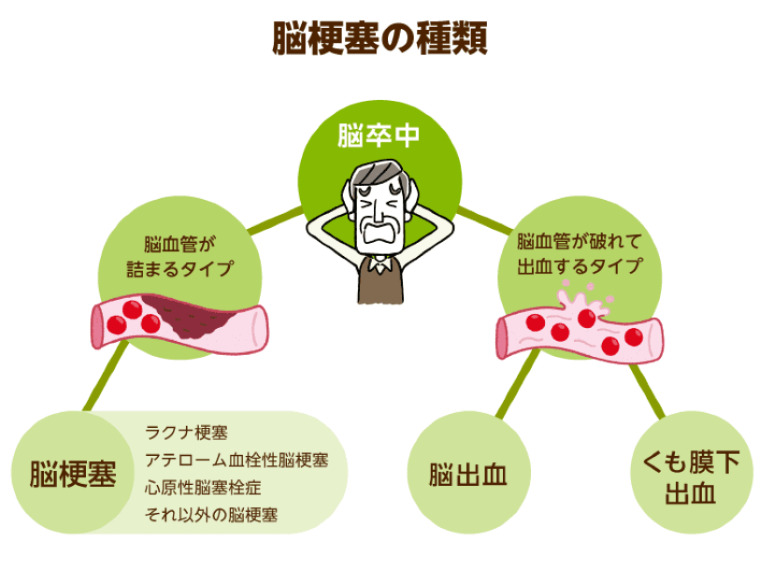 防止