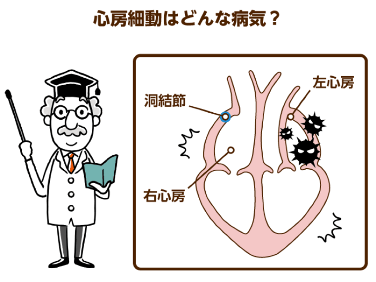 心房細動はどんな病気か解説するひげの博士